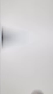 🔆 ¿Qué es el IPL y por qué es uno de los tratamientos más completos para mejorar la piel?
El Dr. Mario León, especialista en medicina estética en Sevilla, explica de forma clara cómo el láser IPL trabaja sobre la piel para mejorar:
✔ Manchas solares y léntigos
✔ Rojeces, cuperosis y pequeñas venitas
✔ Tono irregular
✔ Textura apagada
✔ Luminosidad y uniformidad general
El IPL actúa a través de impulsos de luz intensa, que reconocen selectivamente las alteraciones del color en la piel para mejorar su apariencia, unificar el tono y aportar ese glow tan característico.
Un tratamiento ideal para quienes buscan una piel más limpia, luminosa y uniforme, sin necesidad de procedimientos invasivos.
📍 Clínica Belveh · Medicina Estética en Sevilla
📞 604 985 625
⚕️ Los resultados pueden variar según cada paciente. Es necesaria valoración médica previa por parte de nuestros especialistas.
✨ Déjanos un comentario si te gustaría ver más vídeos del Dr. Mario León explicando tratamientos.