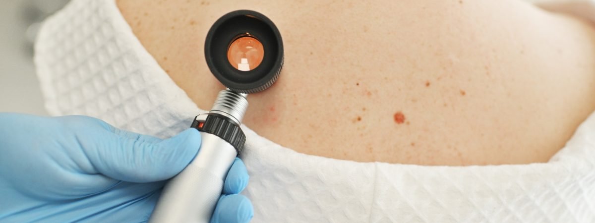 a-dermatologist-examines-moles-and-skin-growths-on-the-patient-s-body-using-a-special-device-a.jpg